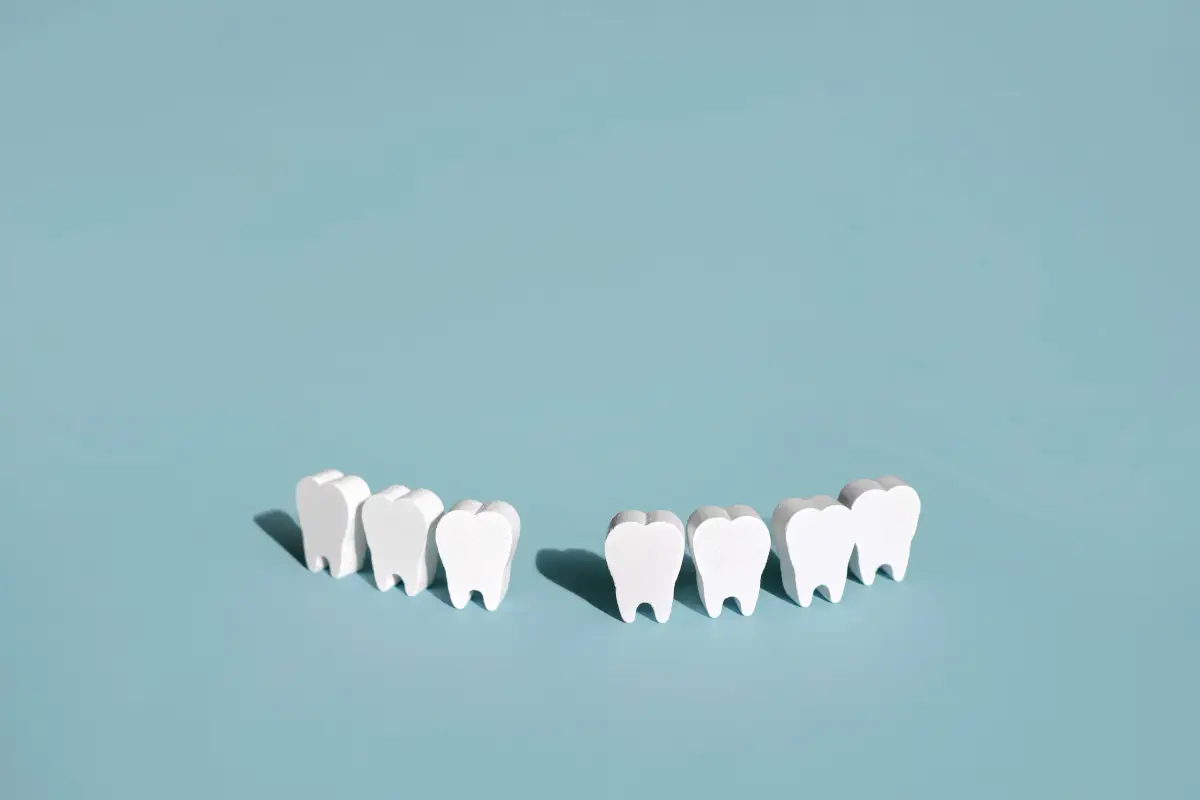 Agenesia dentale